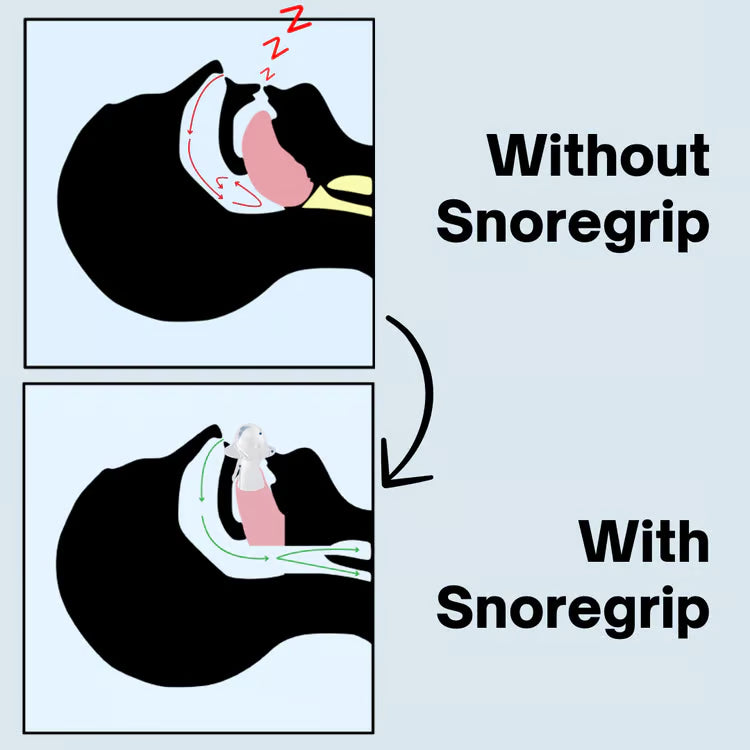 Snore Grip Pro