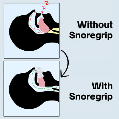 Snore Grip Pro
